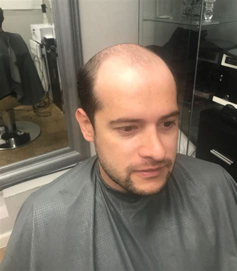mens hair restoration st louis|Best places for a men's haircut in st Louis : r/StLouis .